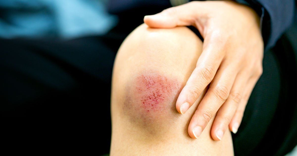 Inflammation in the Body 2